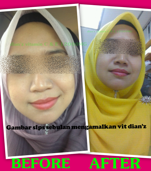 IQ COLLECTION: DIAN'Z VITAMIN C AND E PLUS WHITENING 