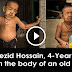 Meet Bayezid Hossain, 4-Year-Old Boy trapped in the body of an old man