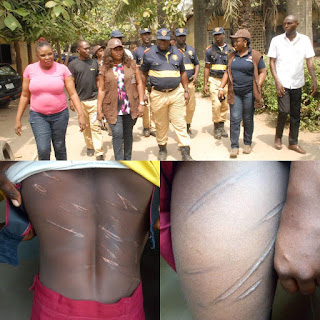 Lagos state government rescues 14 year old physically abused teenager .