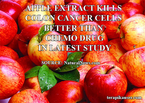 Apple extract kills colon cancer cells better than chemo 