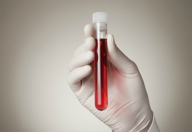 Scientists Develop Blood Test That Can Detect Cancer Four Years Before Symptoms