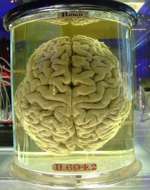 Человеческий мозг в чане