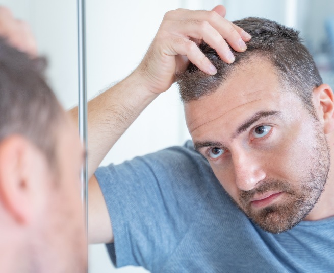 how to stop hair loss without taking medications