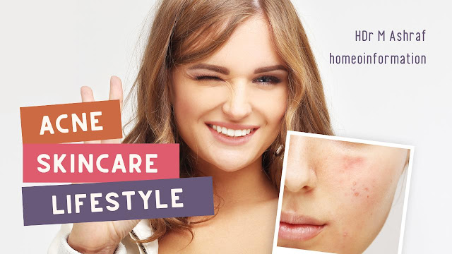 Acne Skin Care For Women Tips and Tricks - Lifestyle Changes for Better Skin