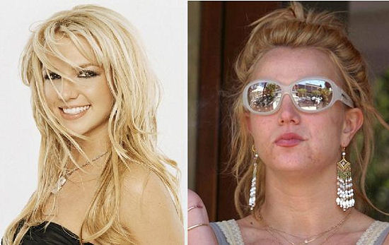 Britney spear Partially true as the before look is kinda after she gave
