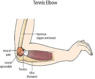 Stiff Elbow Joint Pain Treatment : If You've Got 5 Minutes Along With A Broomstick, I'll Show You How To End Agonizing Elbow Ache... Once And For Just About All.