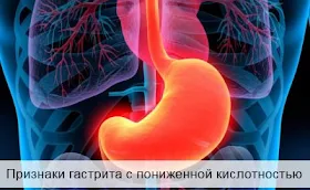 Признаки гастрита с пониженной кислотностью