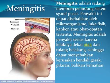 Informasi Jadwal  dan Tempat Suntik Meningitis Buku 