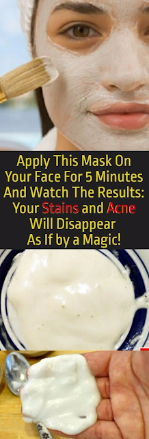Apply This Mask On Your Face For 5 Minutes – Your Scars and Stains Will Disappear in No Time