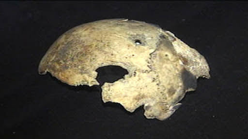 හිට්ලර්ගේ දේහයට සිදු වූයේ කුමක්ද ? (What Happened To Hitler's Body) - Your Choice Way