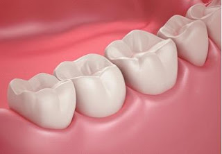 Implant Dentistry Chicago