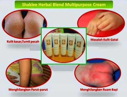 Image result for kelebihan herbal blend cream shaklee