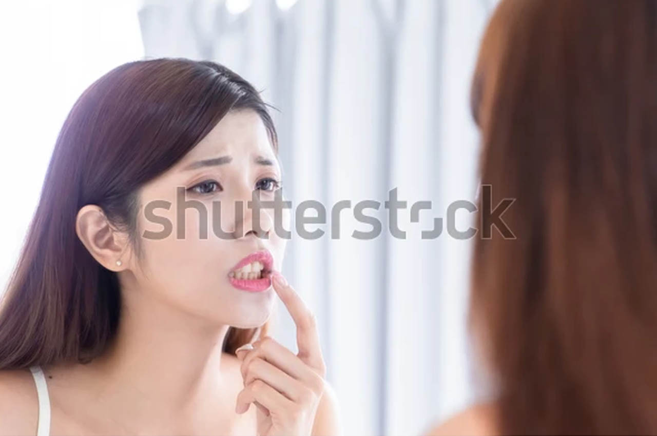 remedies for germ disease