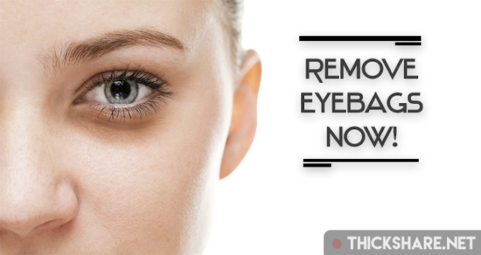 10 How to Eliminate Eye Bags Naturally Without Surgery 