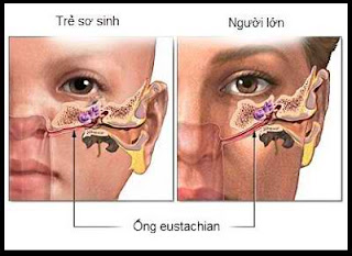 Cấu tạo tai khiến trẻ dễ bị bệnh viêm tai giữa