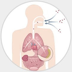 Mesothelioma Cancer Causes - Peritoneal Mesothelioma Causes Asbestos Symptoms