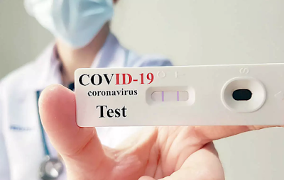 COVID19 Rapid Test Kits Market 