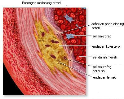 Potongan melintang arteri