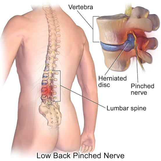 Lower Back Internal Organs / A General Introduction To The ...