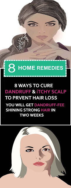 8 Ways To Cure Dandruff And Itchy Scalp To Prevent Hair Loss