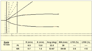 Viscoelastic Measures of Coagulation