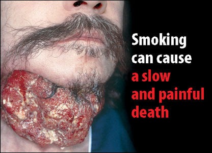 InfoKanserPayudara: Rokok Punca Kanser