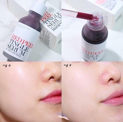 Red Peel Tingle Serum Hàn Quốc có tốt không