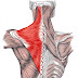 Trapezius Muscle Pain