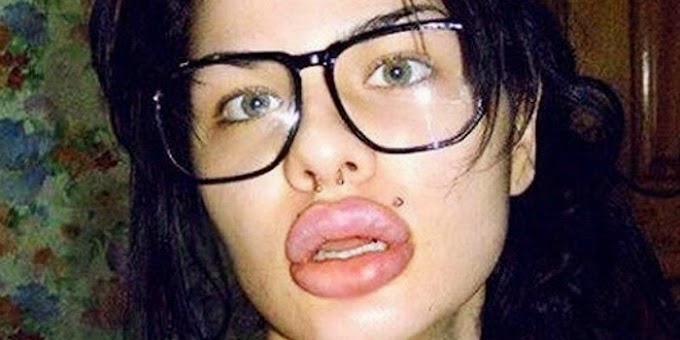 La mujer con los labios más grandes del mundo