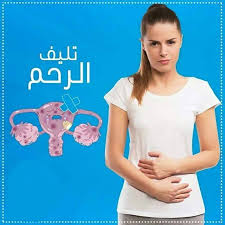 تليف الرحم.. اعراضه وعلاجه