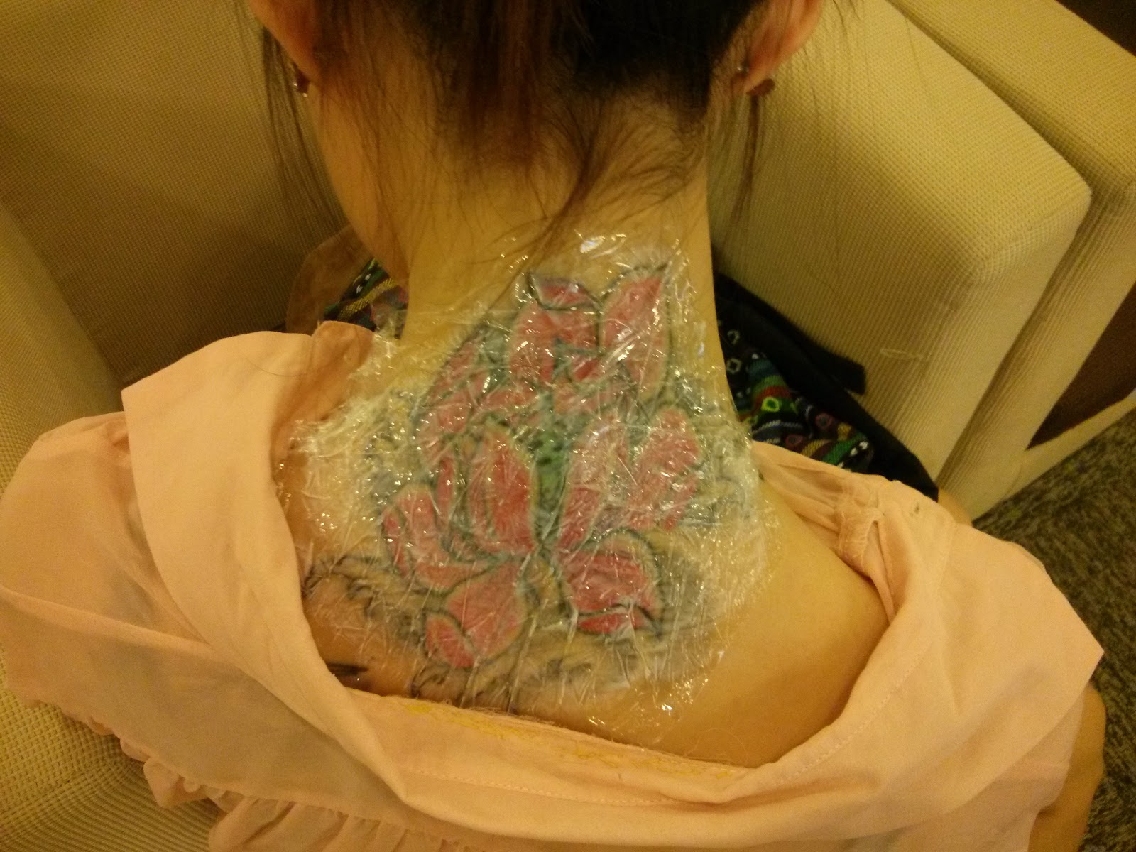 Tattoo Removal Process