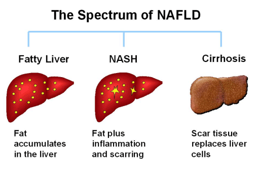 Liver Disease Photos