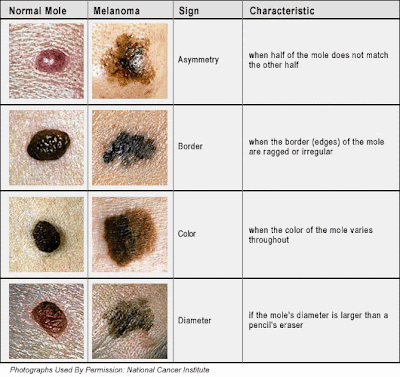 cancerous moles on foot. Skin Cancer Awareness