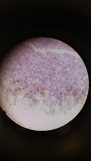 Penicillium (conidiophore)