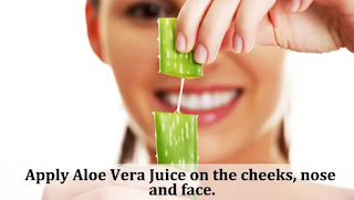 Tips to Eliminate Blackheads Naturally