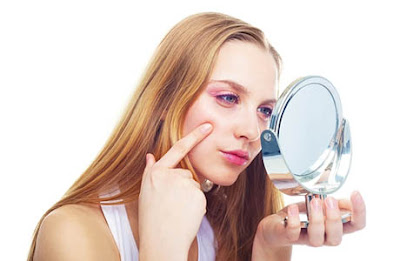 Myths Regarding Acne