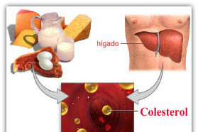Apa Itu Kolesterol ?