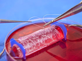 Professor Yuanyuan Zhang, assistant professor at the Wake Forest Institute for Regenerative Medicine, demonstrates the process to engineer a vaginal organ in this undated handout photo provided by the Wake Forest Institute for Regenerative Medicine. 