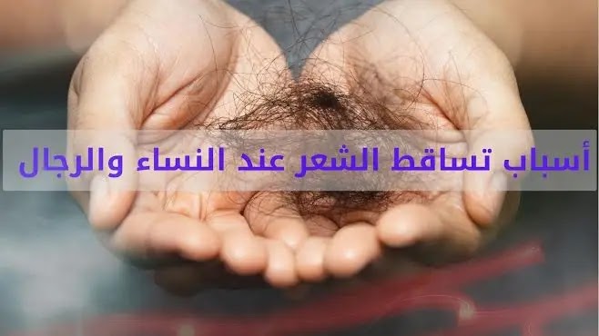 الأسباب لتساقط الشعر