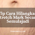 8 Tip Cara Menghilangkan Stretchmark Secara Semulajadi Dengan Cepat Dan Berkesan