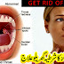 How To Get Rid Of Tonsillitis - Home Remedies