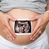 Protest trudnica kao odgovor na "borbu" vlade za natalitet!