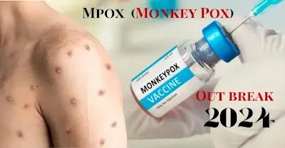 Mpox (Monkeypox) in 2024