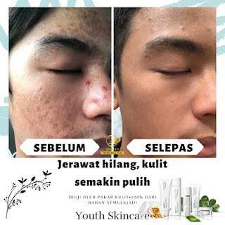 Testimoni Youth Skincare Shaklee Untuk Kulit Muka Lelaki