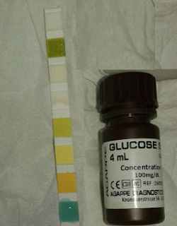 معايير ضبط جودة الشرائط urine strips المستخدم في تحليل عينه البول الكيميائي - Glucose  