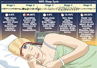 Tahapan-tahapan tidur