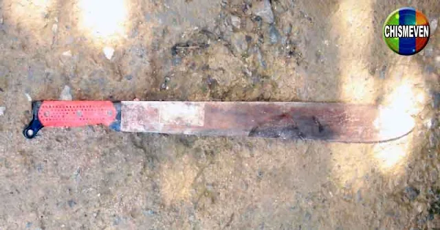 Niño de 9 años murió jugando con un machete en Lara