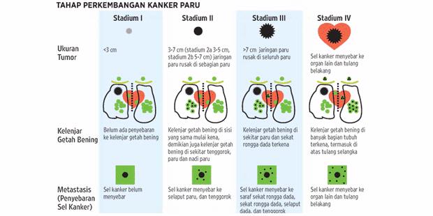 Stadium kanker paru-paru