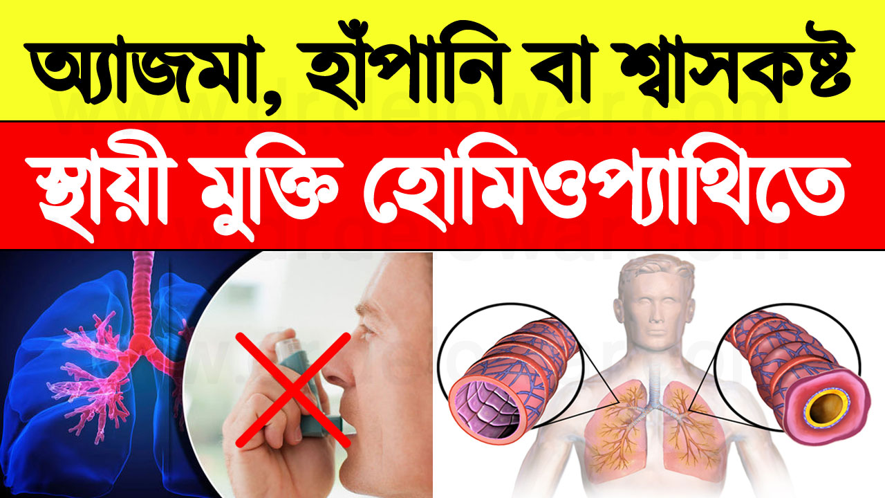 অ্যাজমা Asthma - কারণ, লক্ষণ এবং হাঁপানি থেকে মুক্তির উপায়