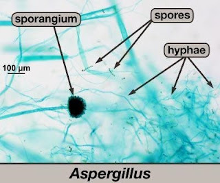 Aspergillus